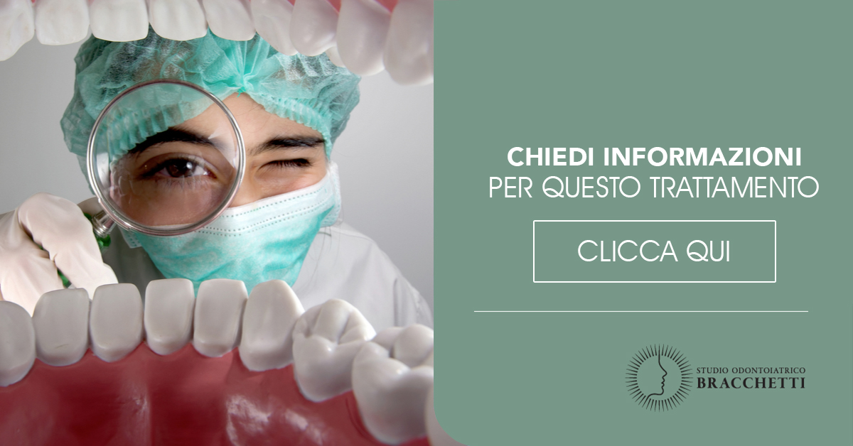 Chirurgia orale Parodontale Milano